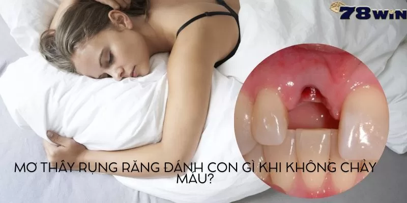 Mơ thấy rụng răng đánh con gì khi không chảy máu?